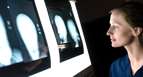student stuides x-ray images